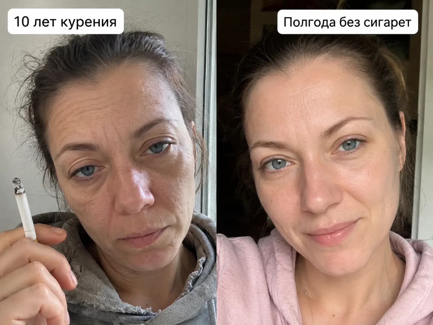 Ольга до отказа от сигарет и спустя полгода без них